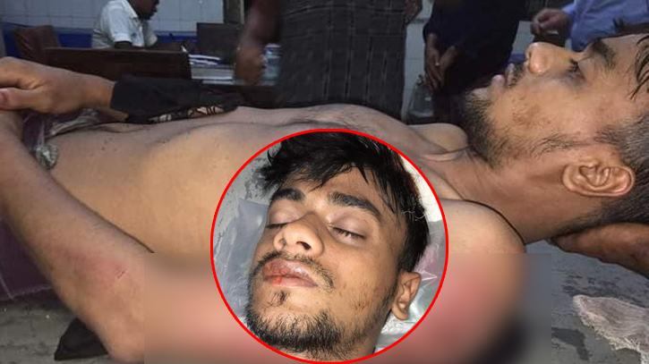 কালিগঞ্জে কোচিং না করায় এক শিক্ষার্থীকে নির্যাতন, হাসপাতালে ভর্তি কালিগঞ্জে কোচিং না করায় এক শিক্ষার্থীকে নির্যাতন, হাসপাতালে ভর্তি