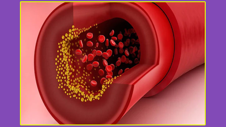যে খাবারগুলো কোলেস্টেরল কমাবে ম্যাজিকের মতো
