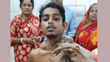 গাছের ছালের মত বিরল রোগে আক্রান্ত অনার্স পড়ুয়া রাজিব
