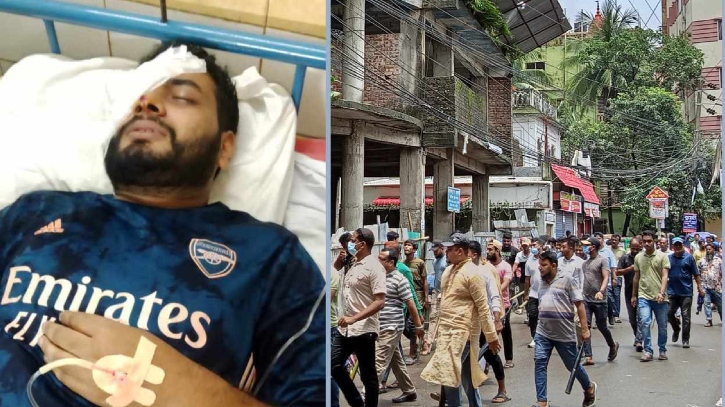 কুমিল্লায় শিক্ষার্থী ও সাংবাদিক দেখলেই মারধর, ৮ জন গুলিবিদ্ধ কুমিল্লায় শিক্ষার্থী ও সাংবাদিক দেখলেই মারধর, ৮ জন গুলিবিদ্ধ