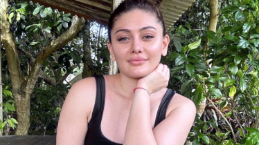 দীর্ঘদিন ধরে ‘অ্যান্টি-এজিং ট্রিটমেন্ট’ নিচ্ছিলেন শেফালী