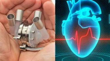 ভারতে আইআইটি কানপুর তৈরি করছে ‍কৃত্তিম হার্ট