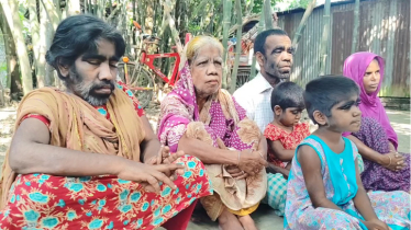 শরীরজুড়ে লোম, বোঝা দায় নারী না পুরুষ (ভিডিও)