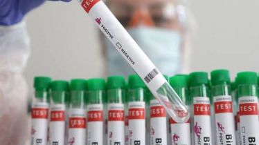 নিপাহ ভাইরাসের সঙ্গে ভারতে আরেক প্রাণঘাতী ভাইরাসের হানা, জরুরি সতর্কতা