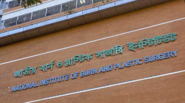 পানির ট্যাংক পরিষ্কার করার সময় বিস্ফোরণ, শিশুসহ চারজন দগ্ধ