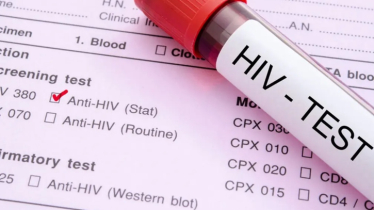 বাংলাদেশে অবিবাহিত তরুণদের মধ্যে উদ্বেগজনক হারে বাড়ছে এইচআইভি সংক্রমণ