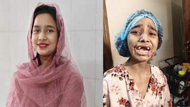 নির্মমতার শিকার সেই গৃহকর্মী কল্পনা মৃত্যুর দুয়ার থেকে ফিরল মিষ্টি হাসিতে