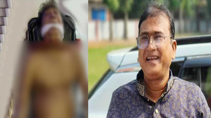 এমপি আনার হত্যার ছবি ও চাঞ্চল্যকর তথ্য প্রকাশ এমপি আনার হত্যার ছবি ও চাঞ্চল্যকর তথ্য প্রকাশ