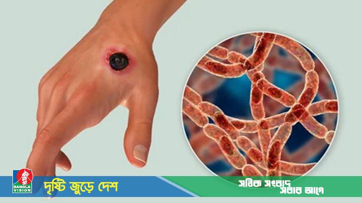 আরও ১১ জনের শরীরে অ্যানথ্রাক্সের উপসর্গ, আক্রান্ত হলো যেভাবে