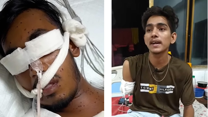 হাসপাতালে কাতরাচ্ছে ওরা: কারো শরীরে গুলি, কেউবা আজ পঙ্গু হাসপাতালে কাতরাচ্ছে ওরা: কারো শরীরে গুলি, কেউবা আজ পঙ্গু