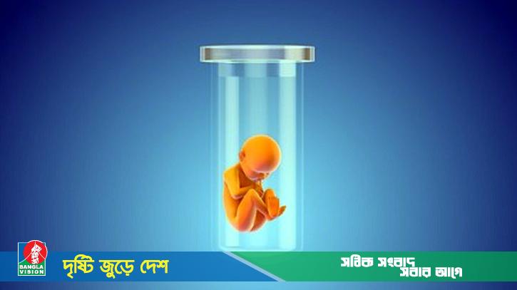 টেস্ট টিউব ও সারোগেসির মাধ্যমে সন্তান জন্ম দেওয়া কি জায়েজ?