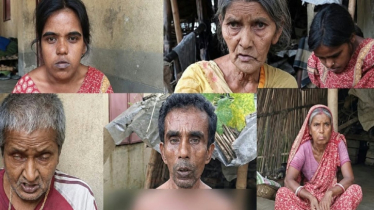 এক পরিবারের পাঁচজনই প্রতিবন্ধী, নিত্যদিনের বেঁচে থাকার সংগ্রাম