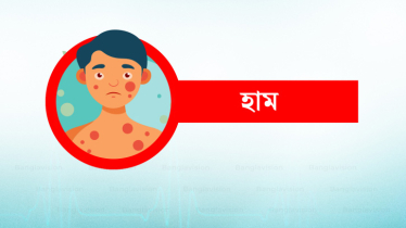 হামে একদিনে আরও ৮ শিশুর মৃত্যু!