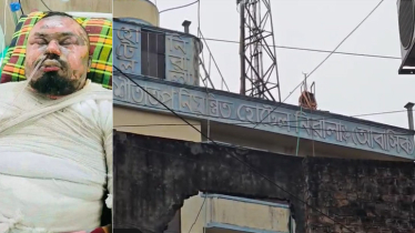 বিনামূল্যে মদ না পেয়ে কর্মচারীকে পেট্রোল ঢেলে আগুনে ঝলসে দেয়ার অভিযোগ
