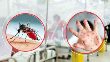 ডেঙ্গুতে আরও ৯ মৃত্যু, হাম কেড়ে নিলো ৬ প্রাণ