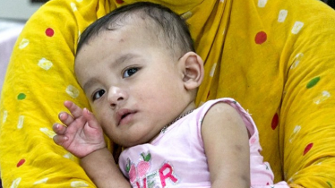 ২৪ ঘণ্টায় হাম ও উপসর্গ নিয়ে আরও ১২ শিশুর মৃত্যু