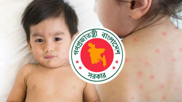 বাড়ছে আতঙ্ক: হাম ও উপসর্গ নিয়ে আরও ৭ শিশুর মৃত্যু বাড়ছে আতঙ্ক: হাম ও উপসর্গ নিয়ে আরও ৭ শিশুর মৃত্যু