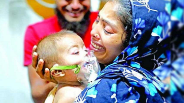 হাম ও উপসর্গ নিয়ে ২৬ দিনে ১৬৬ শিশুর মৃত্যু