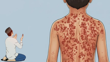 হাম ও অন্যান্য সংক্রামক ব্যাধি থেকে বাঁচতে যে দোয়া পড়বেন হাম ও অন্যান্য সংক্রামক ব্যাধি থেকে বাঁচতে যে দোয়া পড়বেন